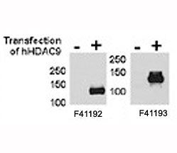HDAC9 antibody NSJ# F41192 and <a href=../tds/hdac9-antibody-f41193>NSJ# F41193</a> were tested by W