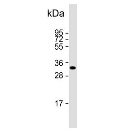 HPGD Antibody / 15-PGDH