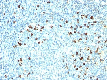 Kappa Light Chain Antibody