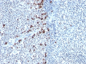 Kappa Light Chain Antibody