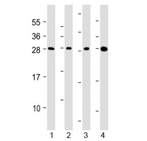 Western blot testing of human 1) HepG2, 2) U266B1, 3) HEK293 and 4) testis lysate with CLEC1B antibody at 1:2000. Predicted molecular weight ~27 kDa.