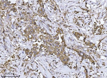 SCA2 Antibody / ATXN2 / Ataxin-2