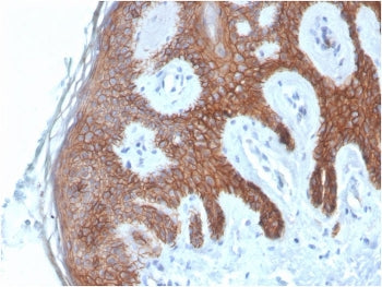 E-Cadherin Antibody / CDH1