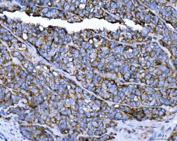 TRPM4 Antibody