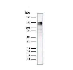EGF Receptor / EGFR Antibody