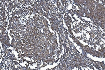 METTL3 Antibody / M6A