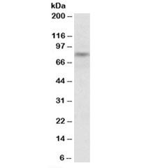 Western blot testing of mouse brain lysate with TRIM2 antibody at 0.1ug/ml. Predicted/observed molec