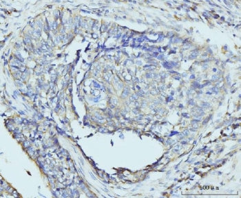 RPL23 Antibody / 60S ribosomal protein L23