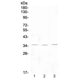 NKG2D Antibody