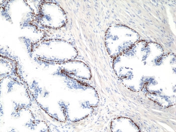 deltaNp63 Antibody / p40