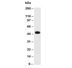 Western blot testing of human cerebellum lysate with PAX6 antibody (clone PAX6/498). Predicted molec