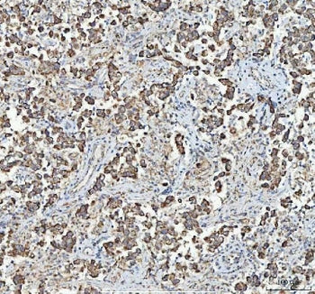MYCBP Antibody / AMY-1