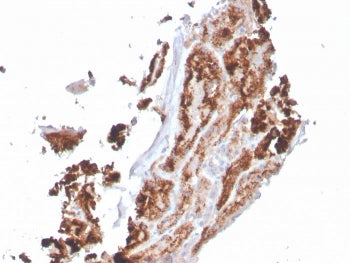 Retinol Binding Protein 4 Antibody / RBP4