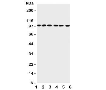 Western blot testing of PIAS1 antibody and Lane 1: rat testis; 2: mouse testis; 3: human HeLa; 4: (h