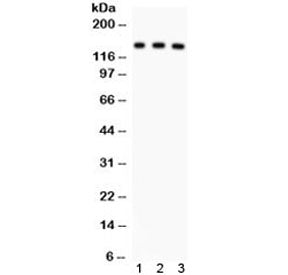 Western blot testing of 1) rat liver, 2) mouse liver and 3) human SMMC lysate with ABCB11 antibody. 