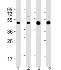 GLUT3 Antibody / SLC2A3