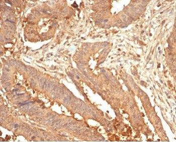 IHC staining of FFPE human colon tissue with Galectin 3 antibody (clone LGALS3/7036R). HIER: boil ti
