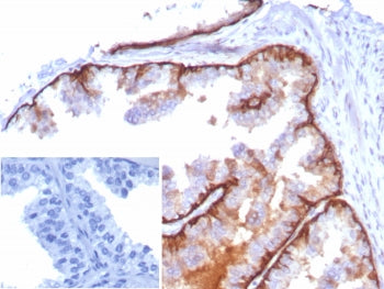Cytokeratin 5 Antibody / KRT5