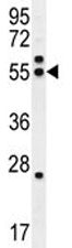 TUBB8B Antibody (Tubulin beta 8B)