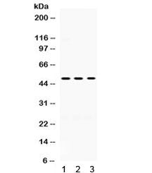 Western blot testing of 1) rat brain, 2) mouse brain and 3) human U87 lysate with OMG antibody. Pred