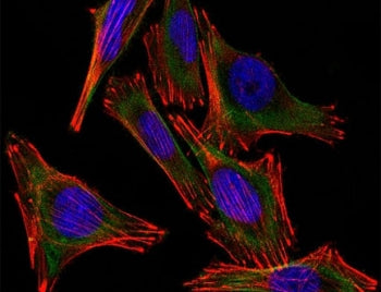 (Left) Confocal Immunofluorescent analysis of A2058 cells using AF488-labeled S100 antibody (green).