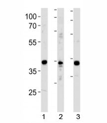 NeuroD1 Antibody