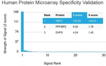 Retinol Binding Protein 4 Antibody / RBP4