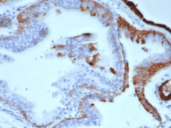 Cytokeratin 14 Antibody / CK14 / KRT14