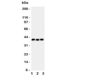 Western blot testing of WNT5A antibody and Lane 1: HeLa; 2: MCF-7; 3: HT1080 lysate. Predicted molec