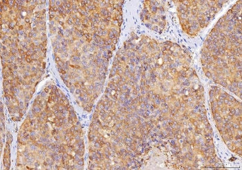 Sorbitol Dehydrogenase Antibody