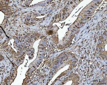 NR2C2 Antibody / TR4 / Testicular receptor 4