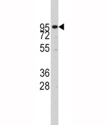 Western blot analysis of ADAM17 antibody and CEM lysate. Expected molecular weight: 80-130KD dependi