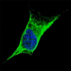 Vimentin Antibody, 0.08ml