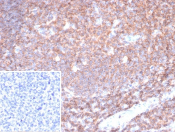 CD45 Antibody (Leukocyte marker)