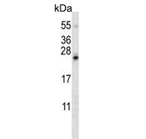 Western blot testing of mouse Neuro-2a cell lysate with SDF2-like protein 1 antibody. Predicted mole