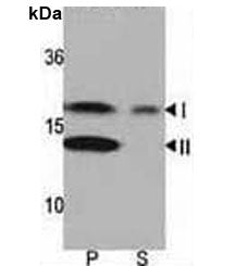 LC3A Antibody (MAP1LC3A)