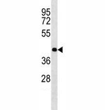 Olig2 Antibody