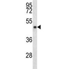 SIRT3 antibody western blot analysis in MDA-MB453 lysate. Predicted molecular weight: 44/28 kDa (ful