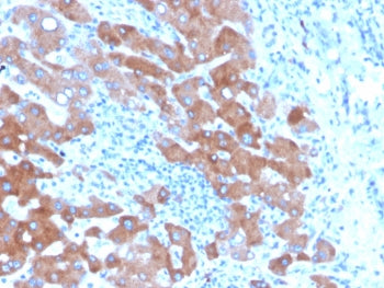 Transferrin Antibody