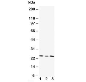 TIMP4 Antibody
