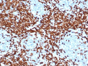 IHC staining of FFPE human thymus with DNA nucleotidylexotransferase antibody (clone DNTT/4506R). HI