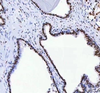 DDX1 Antibody