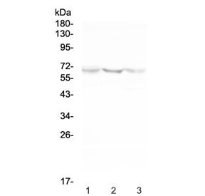 NOX2 Antibody / gp91phox