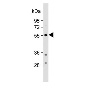 Tryptophan Hydroxylase Antibody / TPH1