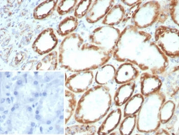FGF-23 Antibody / Fibroblast Growth Factor 23