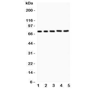RIP1 Antibody