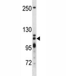 XRN2 Antibody