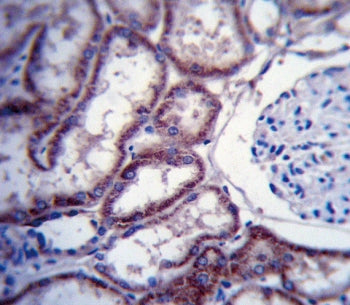FER Antibody / Tyrosine-protein kinase Fer