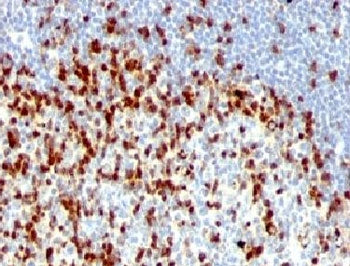 ZAP70 Antibody Cocktail