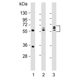 Western blot testing of human 1) HeLa, 2) HL60 and 3) KG-1 cell lysate with Fibroleukin antibody. Pr